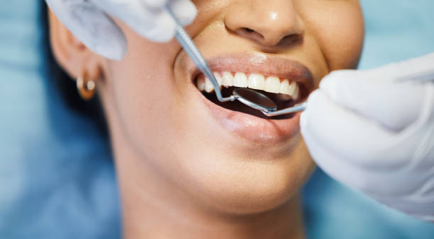 Best Emergency Dentist for Lost Fillings or Crowns in Louise, TX