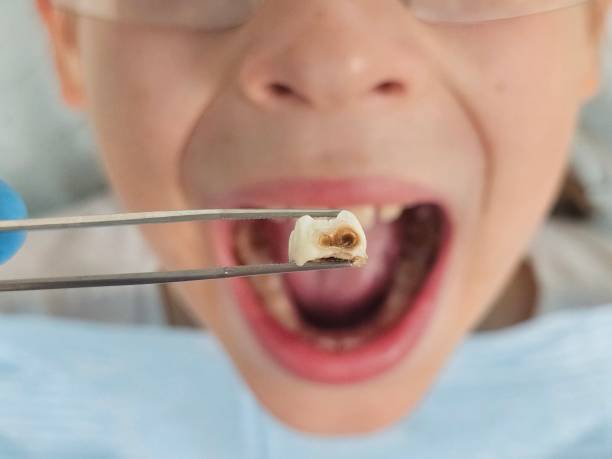 Best Orthodontic Emergency Dentist in Louise, TX